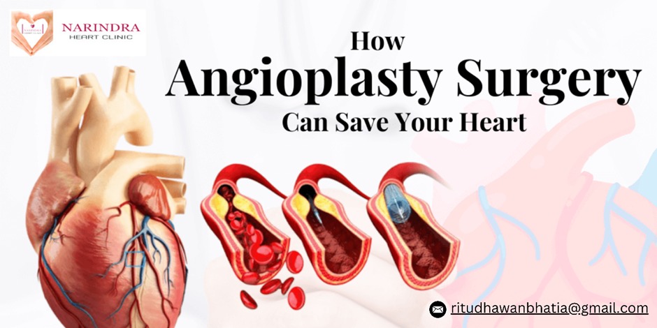 angioplasty surgery